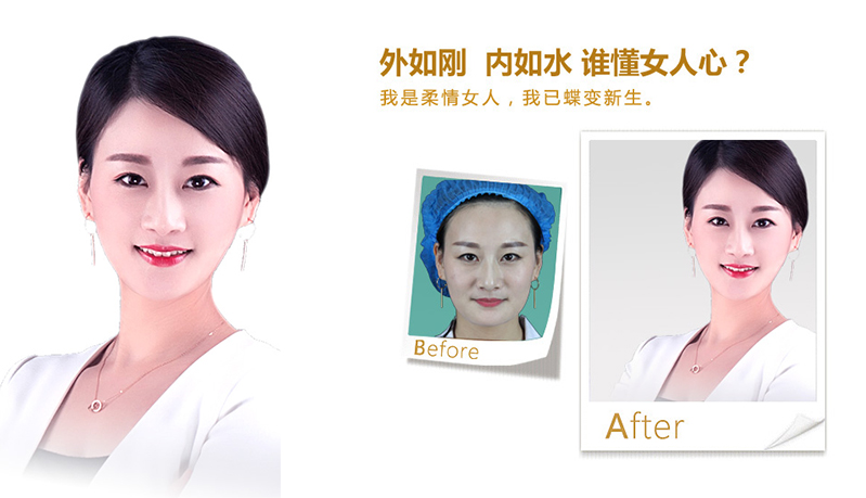 海东地区V脸、线雕隆鼻